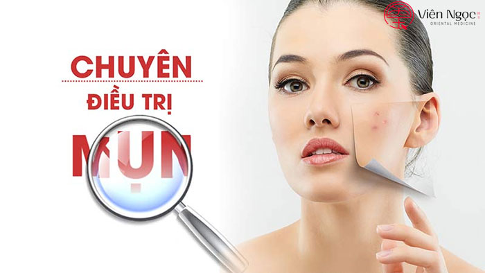 dược viên ngọc gia công kem trị mụn 04